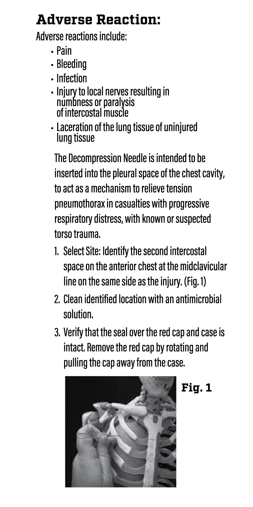 Halo Decompression Needle IFU