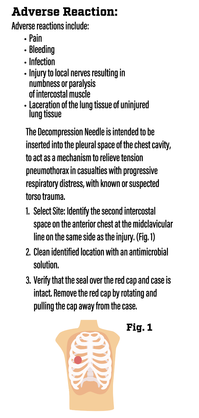Halo Decompression Needle IFU
